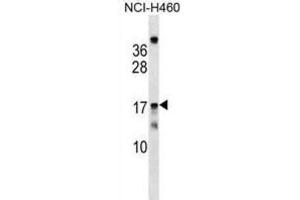 Western Blotting (WB) image for anti-Mitochondrial Ribosomal Protein S11 (MRPS11) antibody (ABIN2999548) (MRPS11 抗体)