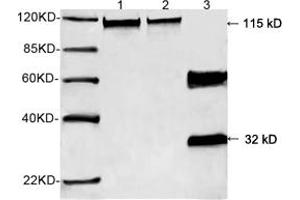 Western blot analysis of recombinant human Calcineurin A protein and mouse brain tissue lysate using 0. (Calcineurin A 抗体  (N-Term))