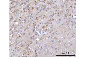 IHC analysis of RARS/RARS1 using anti-RARS/RARS1 antibody (ABIN7600223). (Probable Arginine--tRNA Ligase, Cytoplasmic (RARS-1) (AA 165-425) 抗体)