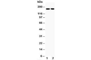 Western blot testing of Topoisomerase II alpha antibody and Lane 1:  HeLa;  2: Jurkat;  Predicted size: 174KD;  Observed size: 174KD