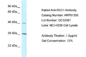 Western Blotting (WB) image for anti-Regulator of Chromosome Condensation 1 (RCC1) (C-Term) antibody (ABIN2788760) (RCC1 抗体  (C-Term))