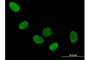 Immunofluorescence of purified MaxPab antibody to DDX5 on HeLa cell. (DDX5 抗体  (AA 1-614))