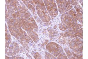 IHC-P Image Immunohistochemical analysis of paraffin-embedded SW480 xenograft, using Tropomyosin 2, antibody at 1:100 dilution. (TPM2 抗体)