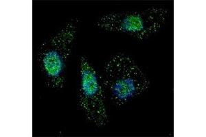 Fluorescent image of Chloroquine treated U251 cells stained with ATG7 antibody at 1:200. (ATG7 抗体  (AA 494-523))