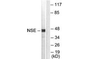 Western blot analysis of extracts from HepG2 cells, using NSE Antibody. (ENO2/NSE 抗体  (AA 371-420))