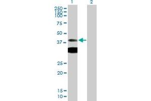 Western Blotting (WB) image for anti-Protein Kinase, CAMP-Dependent, Regulatory, Type I, alpha (Tissue Specific Extinguisher 1) (PRKAR1A) (AA 1-381) antibody (ABIN519180)
