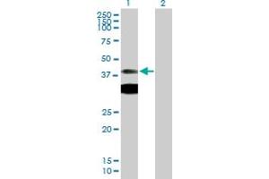 Western Blot analysis of PRKAR1A expression in transfected 293T cell line by PRKAR1A MaxPab polyclonal antibody. (PRKAR1A 抗体  (AA 1-381))