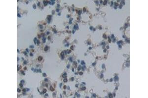 Used in DAB staining on fromalin fixed paraffin- embedded Kidney tissue (ITGA2 抗体  (AA 212-370))