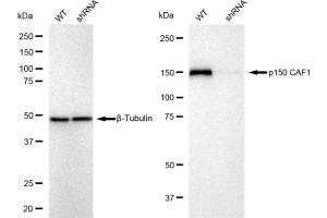 Western blotting analysis using p150 CAF1 antibody (ABIN7798059).