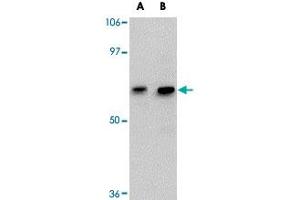 Western blot analysis of GALNT10 in SK-N-SH cell lysate with GALNT10 polyclonal antibody  at (A) 1 and (B) 2 ug/mL . (GALNT10 抗体  (C-Term))