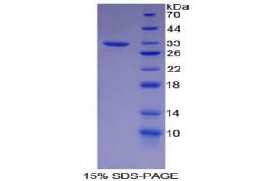 SDS-PAGE analysis of Mouse Cadherin 16 Protein. (Cadherin-16 Protein (CDH16))