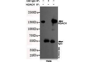 Immunoprecipitation analysis of Hela cell lysates using HDAC4 mouse mAb. (HDAC4 抗体  (N-Term))