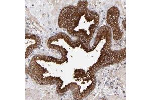 Immunohistochemical staining of human prostate with MIPOL1 polyclonal antibody  shows strong cytoplasmic positivity in glandular cells.
