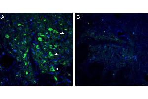 Expression of 5HT2A Receptor in rat dorsal raphe nucleus. (HTR2A 抗体  (Extracellular))
