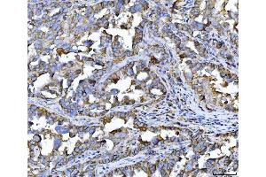 IHC analysis of CD147/Emmprin using anti-CD147/Emmprin antibody (ABIN7599999).