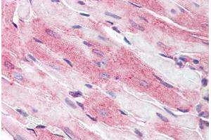 Mouse heart: Formalin-Fixed, Paraffin-Embedded (FFPE) (CD36 抗体  (AA 99-114))