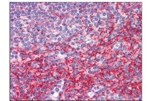 Human Spleen: Formalin-Fixed, Paraffin-Embedded (FFPE) (ATG9B 抗体  (C-Term))