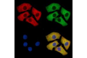 Grp75 Mouse Monoclonal Antibody staining HepG2 cells by IF/ICC.