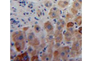 Used in DAB staining on fromalin fixed paraffin-embedded liver tissue (Aggrecan 抗体  (AA 34-147))