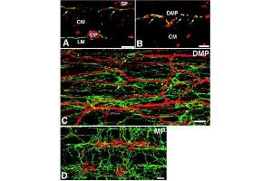 Double-labeling immunofluorescence for c-Kit and nitric oxide synthase (NOS) in the guinea-pig small intestine. (豚鼠 Serum Sterile)