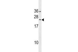 RAB5B antibody western blot analysis in HepG2 lysate. (RAB5B 抗体  (AA 85-112))