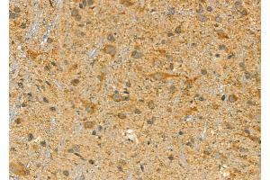ABIN6262757 and ABIN6277156 at 1/100 staining Rat brain tissue by IHC-P.