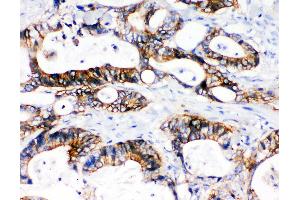 Immunohistochemistry (IHC) image for anti-Solute Carrier Family 12 (Potassium-Chloride Transporter) Member 2 (SLC12A2) (AA 223-241), (N-Term) antibody (ABIN3043994)