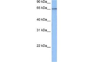 WB Suggested Anti-TAF15 Antibody Titration:  0. (TAF15 抗体  (N-Term))