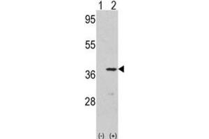 Western Blotting (WB) image for anti-Cyclin-Dependent Kinase 3 (CDK3) antibody (ABIN3003266) (CDK3 抗体)