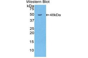 Western Blotting (WB) image for anti-Hyaluronidase-1 (HYAL1) (AA 52-462) antibody (ABIN1859237) (HYAL1 抗体  (AA 52-462))