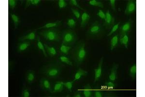 Immunofluorescence of monoclonal antibody to SMAD2 on HeLa cell. (SMAD2 抗体  (AA 181-280))