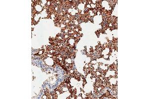 Immunohistochemical analysis of paraffin-embedded mouse lung tissue using (ABIN1539189 and ABIN2838276) performed on the Leica® BOND RXm. (TREM2 抗体  (N-Term))