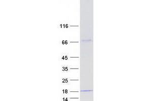 Validation with Western Blot (YPEL5 Protein (Transcript Variant 1) (Myc-DYKDDDDK Tag))