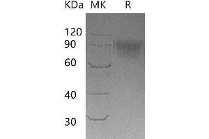 Western Blotting (WB) image for Sialic Acid Binding Ig-Like Lectin 5 (SIGLEC5) protein (His tag) (ABIN7320942)