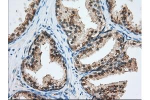Immunohistochemical staining of paraffin-embedded Human Kidney tissue using anti-USP5 mouse monoclonal antibody. (USP5 抗体)