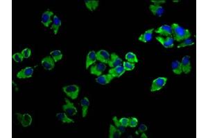 Immunofluorescence staining of Hela cells with ABIN7143330 at 1:33, counter-stained with DAPI. (ADCY5 抗体  (AA 584-719))