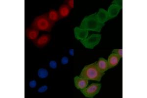 ABIN6255304 and ABIN6267326 staining Hela cells(24h of starvation treatment) by IF/ICC. (Tyrosine Hydroxylase 抗体  (pSer40))
