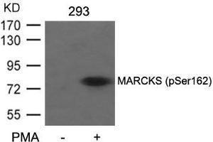 Western blot analysis of extracts from 293 cells untreated or treated with PMA using MARCKS(Phospho-Ser162) Antibody. (MARCKS 抗体  (pSer162))
