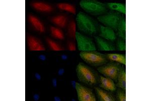 ABIN6261292 and ABIN6278563 staining  cells by IF/ICC. (HSD17B11 抗体  (Internal Region))
