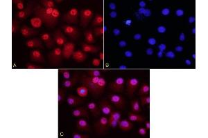 HepG2 cells probed with Rabbit Anti-HURP Polyclonal Antibody (ABIN713861) at 1:200 for overnight 4C followed by Goat Anti-Rabbit IgG, Cy3 conjugated for 40 minutes, at room temperature. (DLGAP5 抗体  (AA 51-150))