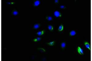 Immunofluorescence staining of A549 cells with ABIN7143175 at 1:166, counter-stained with DAPI. (Activin A Receptor Type IB/ALK-4 抗体  (AA 150-300))