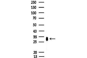 anti-Carbonyl Reductase 1 (CBR1) (C-Term) antibody
