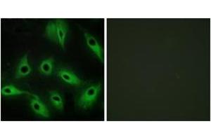 Immunofluorescence analysis of HeLa cells, using CDH9 Antibody. (Cadherin 9 抗体  (AA 201-250))