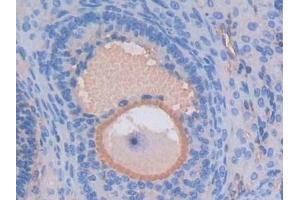 Immunohistochemistry (IHC) image for anti-Albumin (ALB) antibody (ABIN7429667)