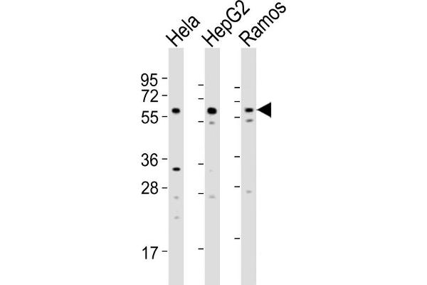 GRK5 抗体  (C-Term)