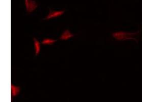 ABIN6266871 staining HepG2 by IF/ICC. (STRADA 抗体  (Internal Region))