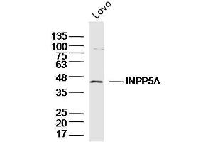 Lovo lysates probed with INPP5A Polyclonal Antibody, Unconjugated  at 1:300 dilution and 4˚C overnight incubation. (INPP5A 抗体  (AA 31-130))