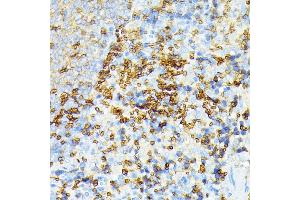 Immunohistochemistry of paraffin-embedded rat spleen using alpha 1 Spectrin antibody (ABIN6129333, ABIN6148401, ABIN6148402 and ABIN6215956) at dilution of 1:100 (40x lens). (SPTA1 抗体  (AA 940-1160))