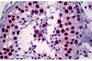 Human Testis: Formalin-Fixed, Paraffin-Embedded (FFPE) (YY1 抗体  (AA 221-321))