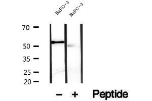 Western blot analysis of extracts of BxPC-3 cells, using VNN1 antibody. (VNN1 抗体)